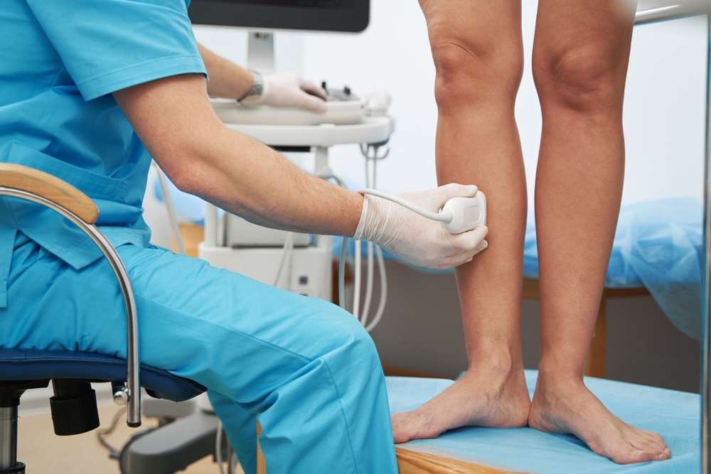 Say Goodbye to Varicose Veins: Tips for Healthy Legs